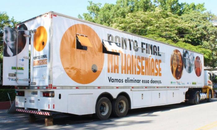 Arapiraca promove ações de conscientização e diagnóstico precoce de Hanseníase.